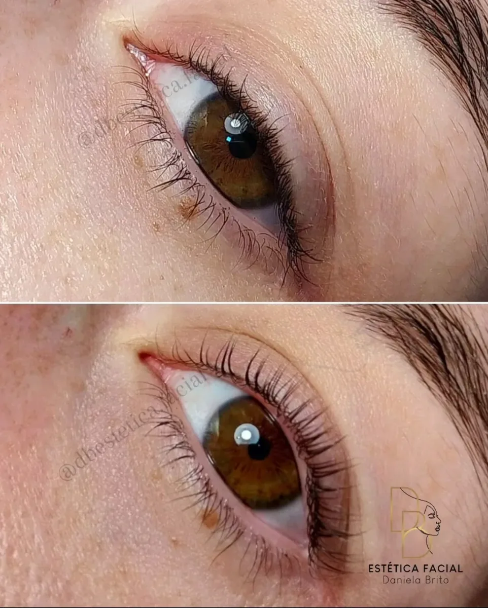 Resultado Natural
