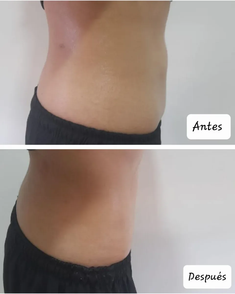 Antes